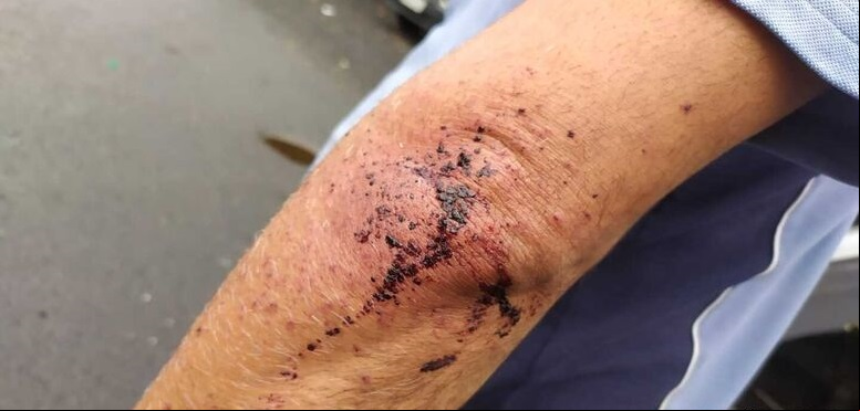  A vítima ficou ferida no braço, por conta dos estilhaços do vidro